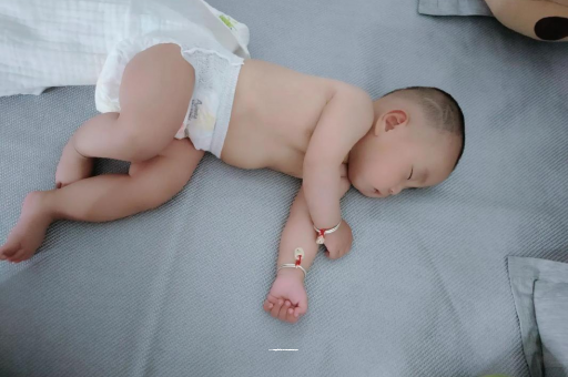 长治宝宝头上长痱子